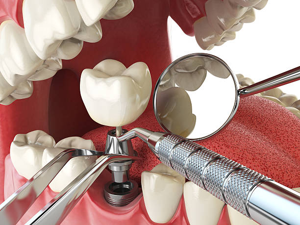 Best Emergency Treatment for Jaw Pain or Injury in Clinton, PA